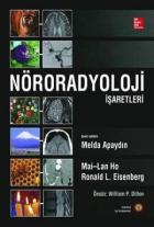 Nöroradyoloji İşaretleri