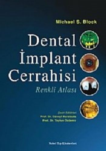Dental İmplant Cerrahisi Renkli Atlası Michael S.Block