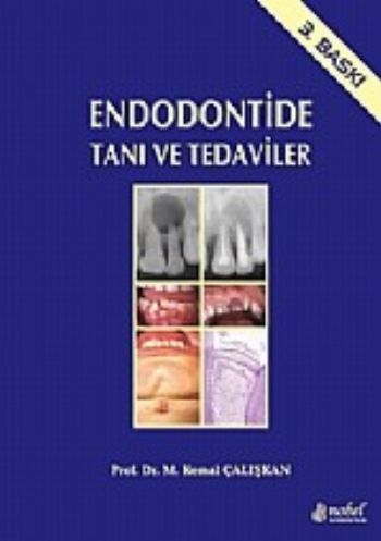 Endodontide Tanı ve Tedaviler
