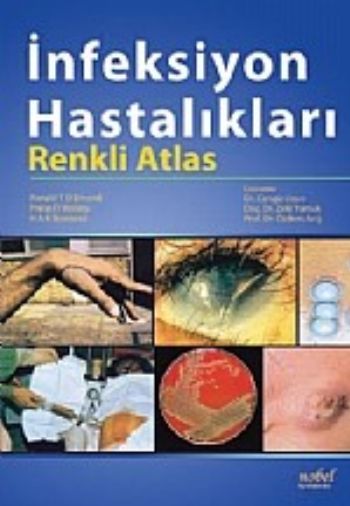 İnfeksiyon Hastalıkları Renkli Atlas